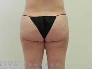 americanlipocenters_48.jpg